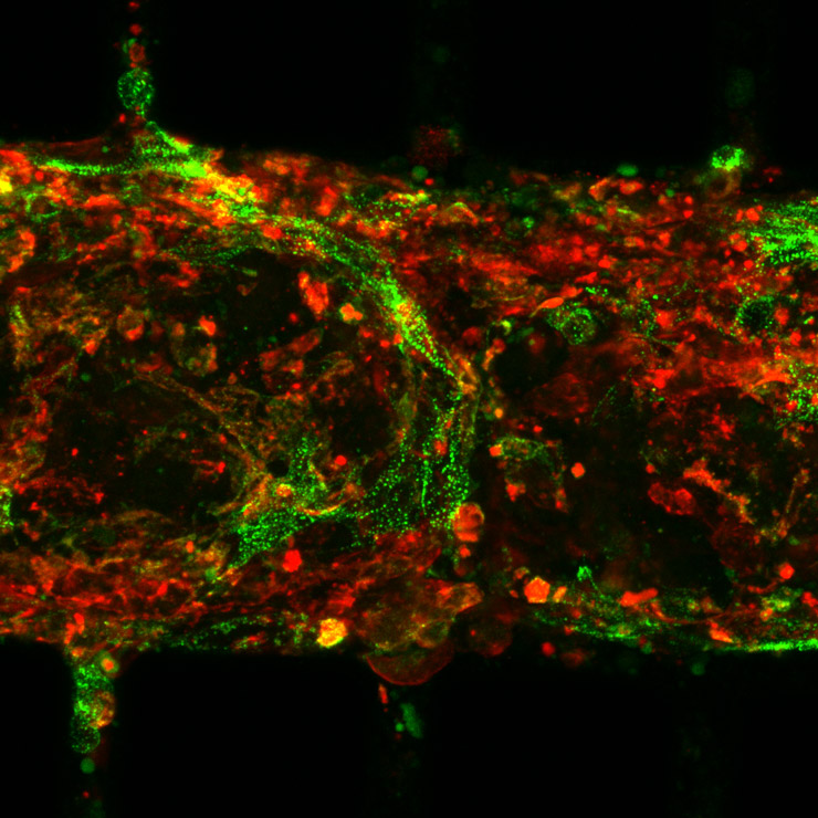 Fluorescent microscope image of cardiomyocytes (heart muscle cells) in a microfluidic chip, with different cell structures highlighted in red and green.