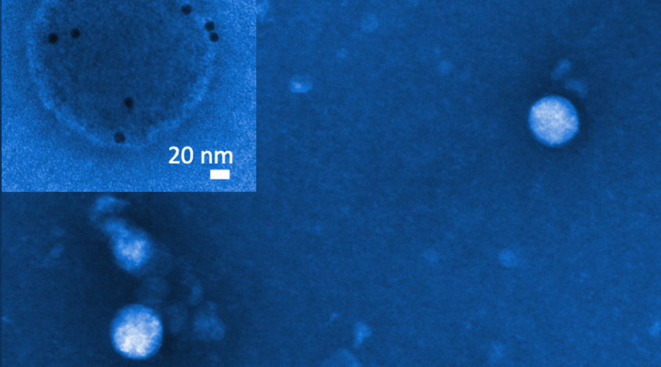 A colorized image of membrane-bound extracellular vesicles